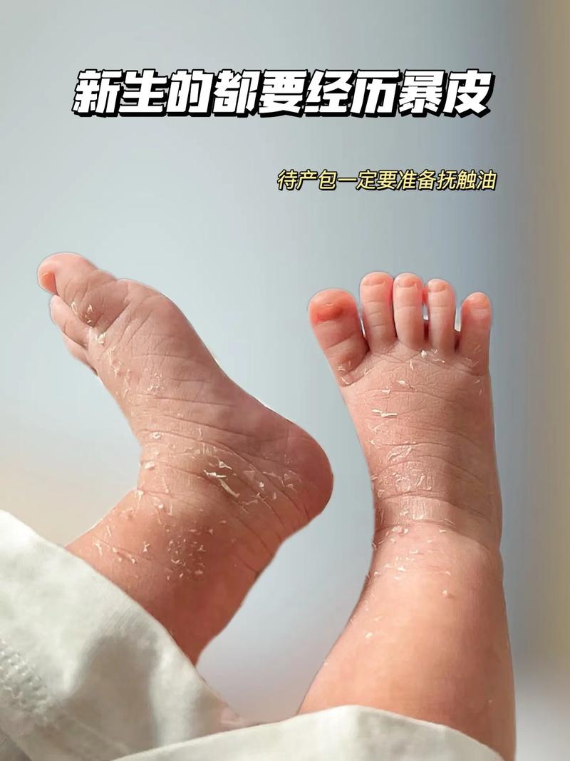 新生儿多久变白(新生儿多久变白皮肤变好)