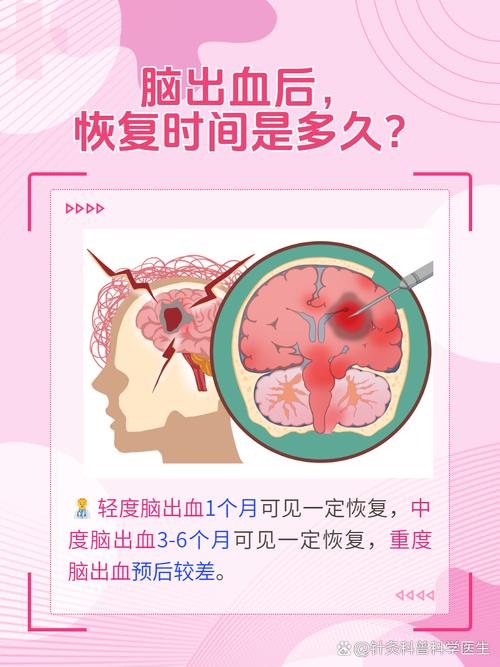 脑干出血能活多久(脑出血能活多久)