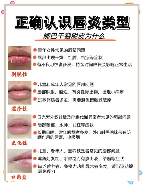 为什么嘴巴会肿(什么原因嘴巴会肿)