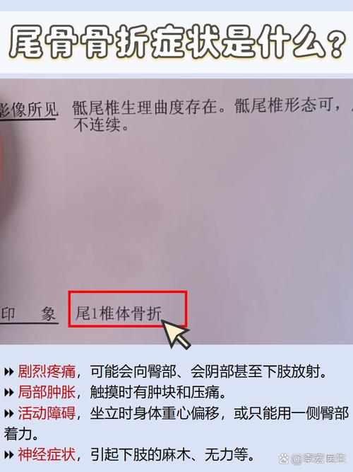 骨折后多久可以同房(尾骨骨折后多久可以同房)-第1张图片-天汇百科网 骨折后多久可以同房(尾骨骨折后多久可以同房)-第1张图片-天汇百科网