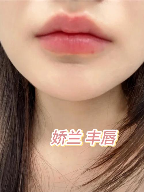 丰唇后多久消肿(丰唇多久消肿变软)