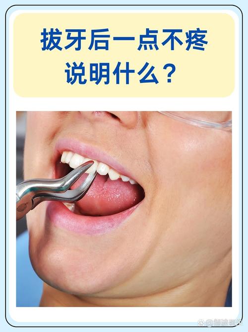 拔牙后多久可以喝水(拔牙后频繁吞咽口水会有什么后果)-第1张图片-天汇百科网 拔牙后多久可以喝水(拔牙后频繁吞咽口水会有什么后果)-第1张图片-天汇百科网