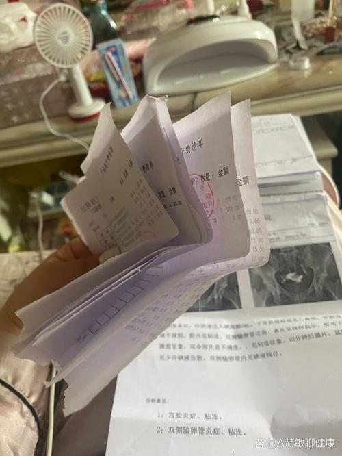 做输卵管造影要多久(做输卵管造影要多久才能备孕)-第1张图片-天汇百科网 做输卵管造影要多久(做输卵管造影要多久才能备孕)-第1张图片-天汇百科网