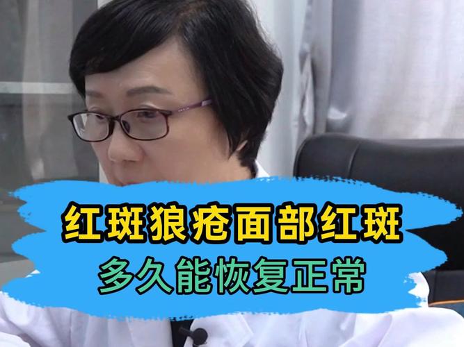 脸上有红斑是怎么回事(脸上有红斑是怎么回事)-第1张图片-天汇百科网 脸上有红斑是怎么回事(脸上有红斑是怎么回事)-第1张图片-天汇百科网