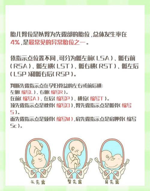 胎儿为什么会臀位(胎宝宝为什么会臀位)