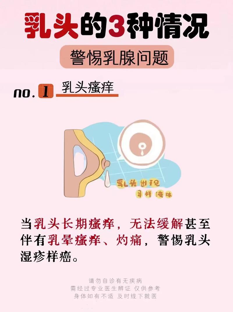 为什么乳房痒痒的(乳房为什么会痒得难受)