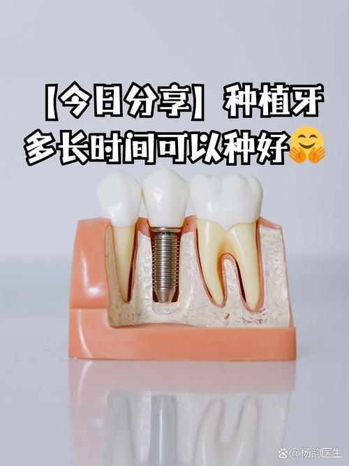 种牙能维持多久(种植牙能用多少年)