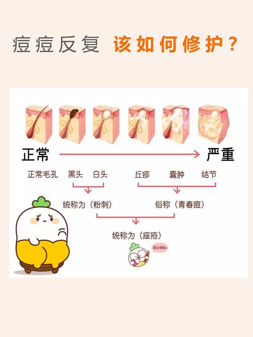 吃辣为什么会长痘(吃辣为什么会长痘痘的原因)