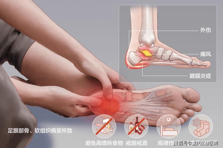 脚踝后面的筋疼因为什么(脚踝后面的筋酸疼因为什么)-第1张图片-天汇百科网 脚踝后面的筋疼因为什么(脚踝后面的筋酸疼因为什么)-第1张图片-天汇百科网