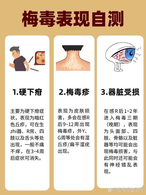 梅毒潜伏期有多久(梅毒潜伏期有多久)-第1张图片-天汇百科网 梅毒潜伏期有多久(梅毒潜伏期有多久)-第1张图片-天汇百科网