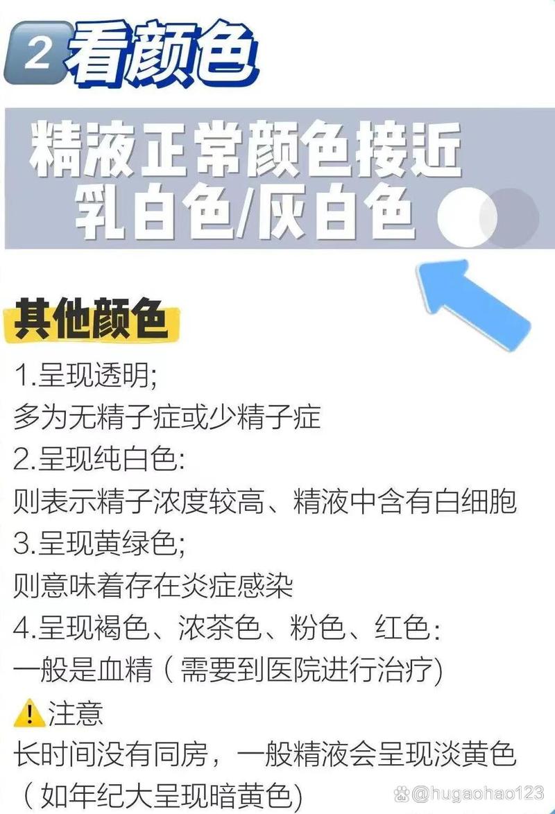 精液检查多久出结果(做精检多久出结果)